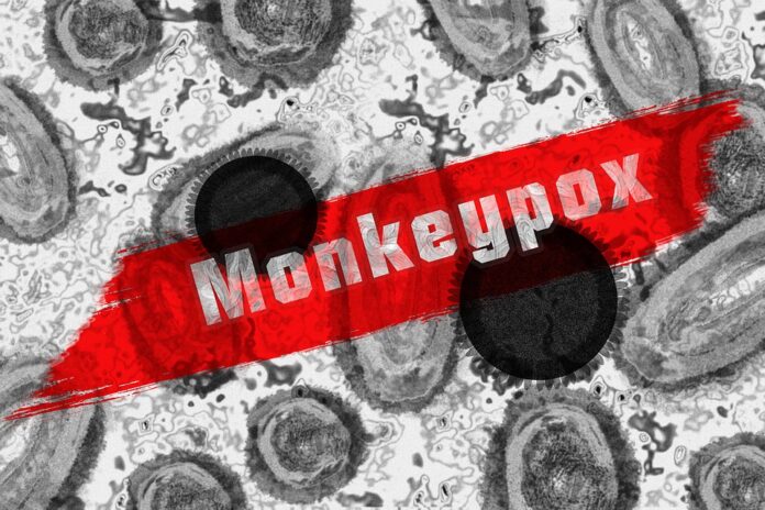 monkey-pox